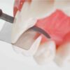FenderWedge® Prep - Image 3